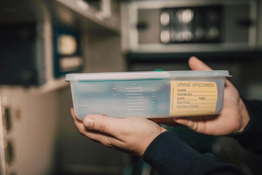 Kraujas šlapime: tyrimo mėginio konteineris su informaciniu lipduku.