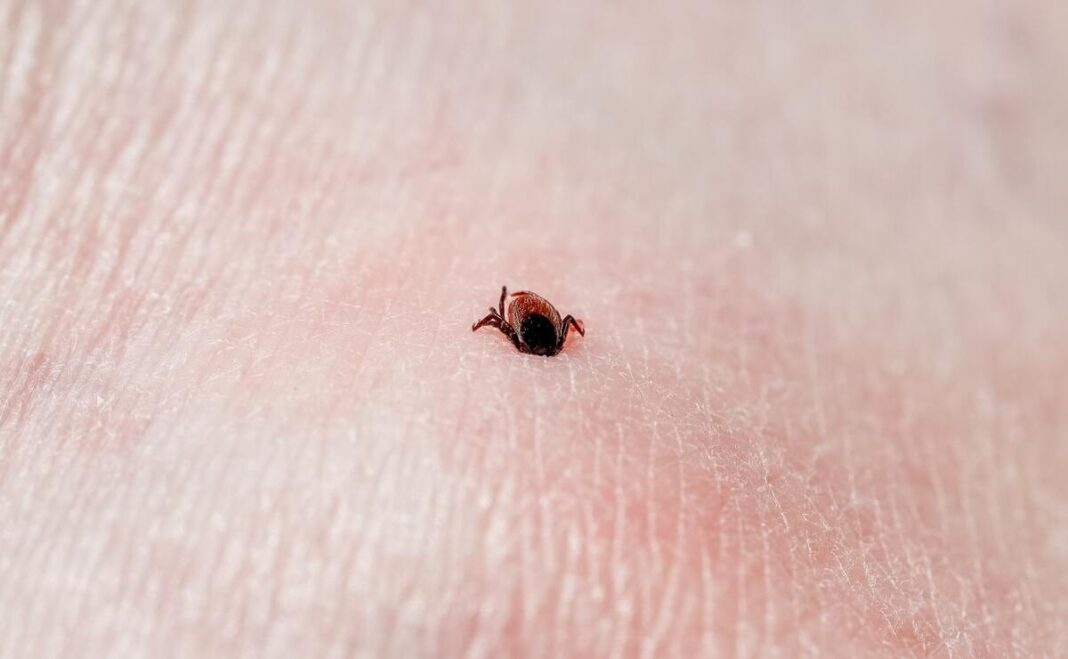 Erkinis encefalitas – erkės įsisiurbimas į odą stambiu planu