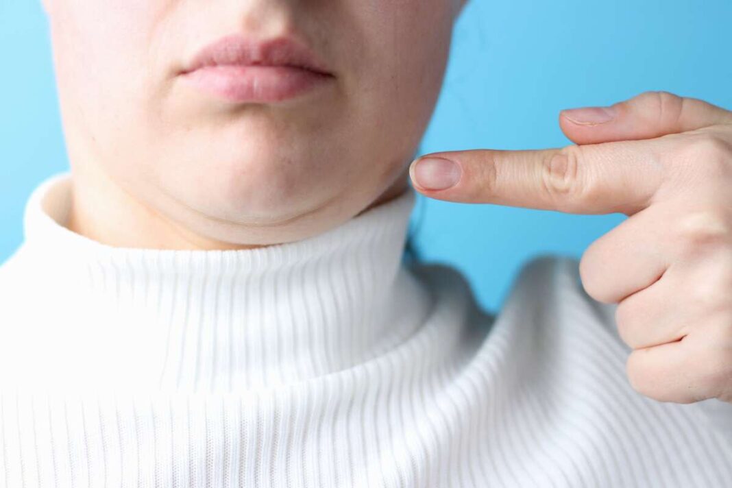Pratimai nuo pagurklo – moteris rodo pirštu į dvigubą smakrą, išryškinant probleminę zoną prieš treniruotę.