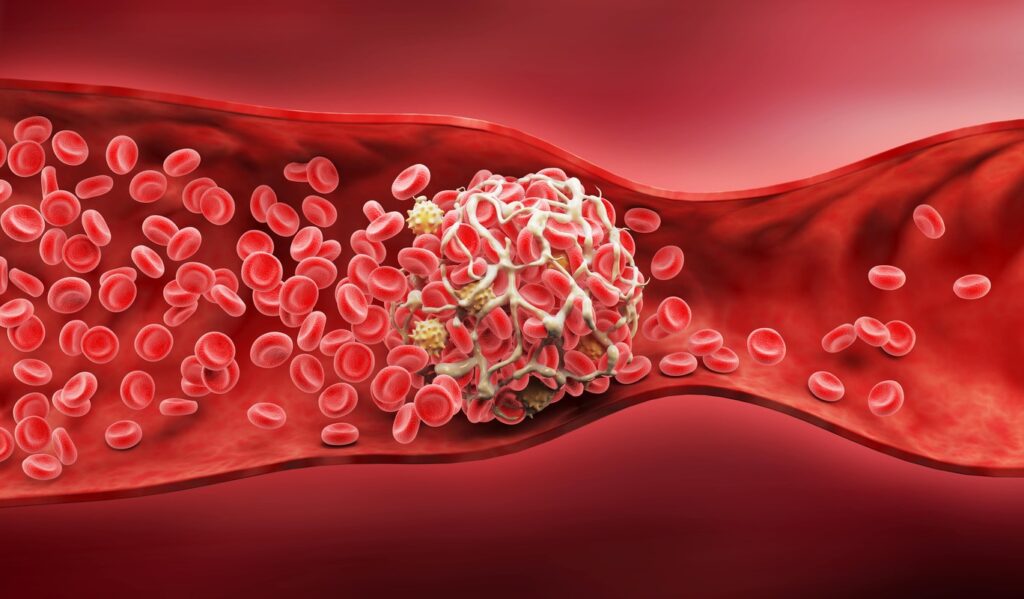Maistas švarioms kraujagyslėms padeda mažinti cholesterolį ir saugo nuo pavojingų kraujo krešulių susidarymo arterijose.