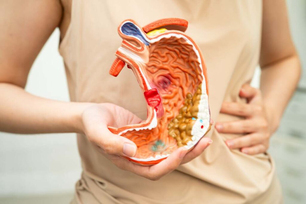 Žarnyno valymas namuose pavaizduotas anatominiu virškinimo modeliu – parodo toksinų kaupimosi vietas.