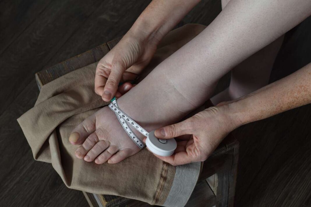 gėrimas nuo skysčių susilaikymo – žmogus matuoja tinusį čiurnos plotą, rodantį skysčių kaupimąsi organizme.