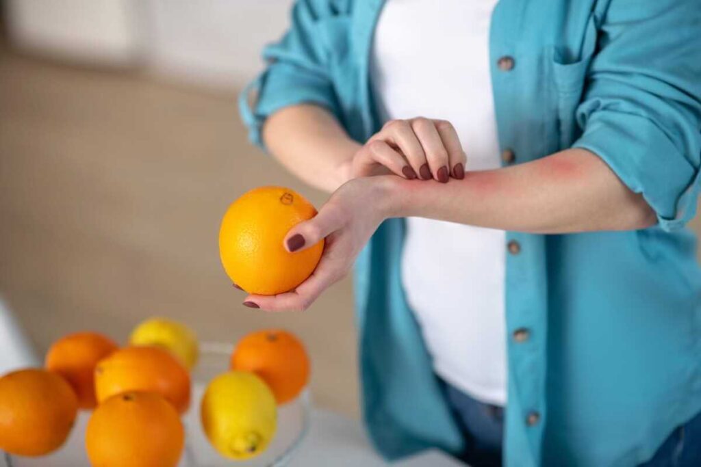Dilgėlinės gydymas nustatant bėrimo priežastį, kurią gali sukelti citrusiniai vaisiai ar kiti maisto alergenai.